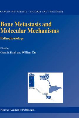 Carte Bone Metastasis and Molecular Mechanisms Gurmit Singh