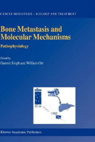 Knjiga Bone Metastasis and Molecular Mechanisms Gurmit Singh