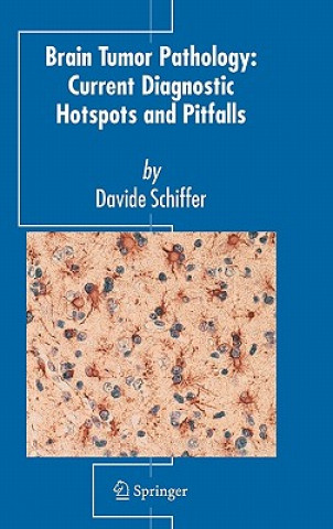 Kniha Brain Tumor Pathology: Current Diagnostic Hotspots and Pitfalls David Schiffer