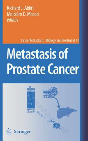 Książka Metastasis of Prostate Cancer Richard J. Ablin