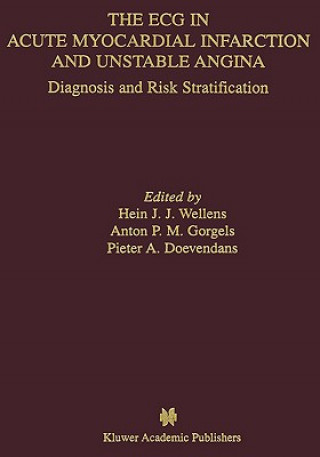 Kniha ECG in Acute Myocardial Infarction and Unstable Angina Hein J. J. Wellens