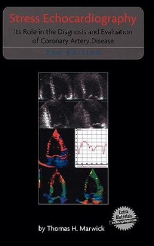 Carte Stress Echocardiography Thomas H. Marwick
