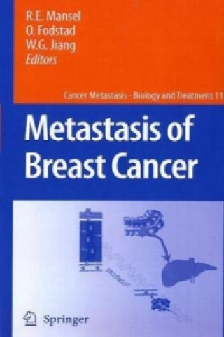Könyv Metastasis of Breast Cancer Robert E. Mansel
