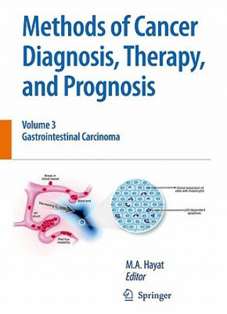 Carte Methods of Cancer Diagnosis, Therapy and Prognosis M. A. Hayat