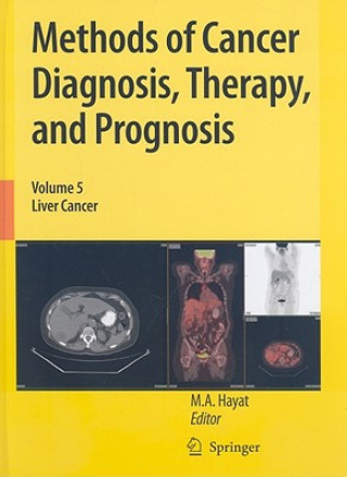 Kniha Methods of Cancer Diagnosis, Therapy, and Prognosis M. A. Hayat