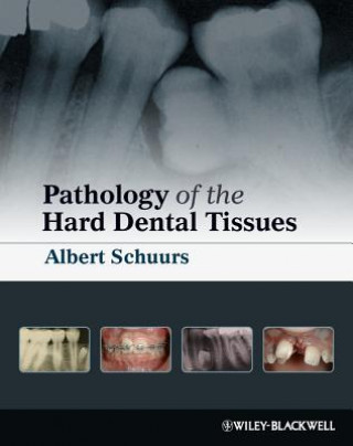 Knjiga Pathology of the Hard Dental Tissues Albert Schuurs