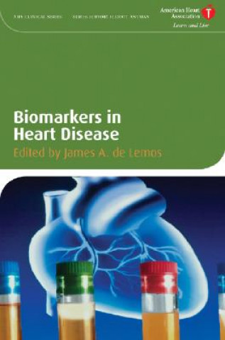 Könyv Biomarkers in Heart Disease James DeLemos