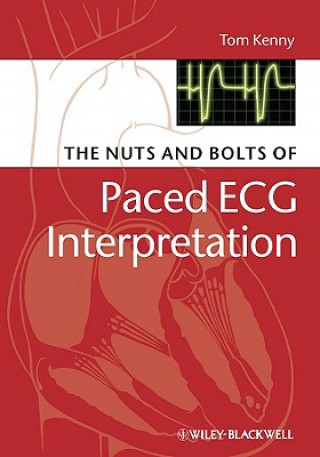Kniha Nuts and Bolts of Paced ECG Interpretation Tom Kenny