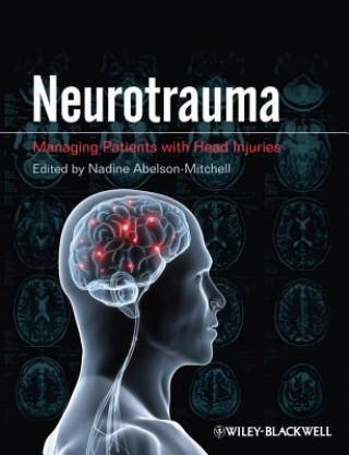 Knjiga Neurotrauma - Managing Patients with Head Injuries Nadine Abelson-Mitchell