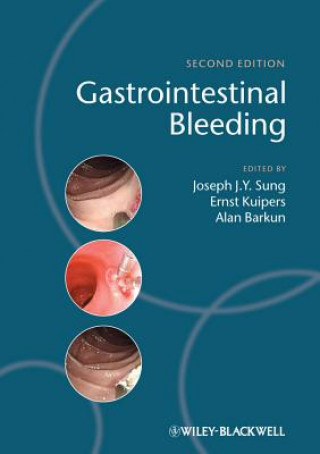 Kniha Gastrointestinal Bleeding 2e Joseph Sung