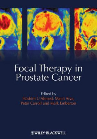 Book Focal Therapy in Prostate Cancer Hashim Uddin Ahmed