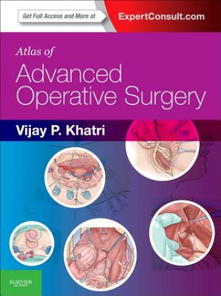 Kniha Atlas of Advanced Operative Surgery Vijay P. Khatri
