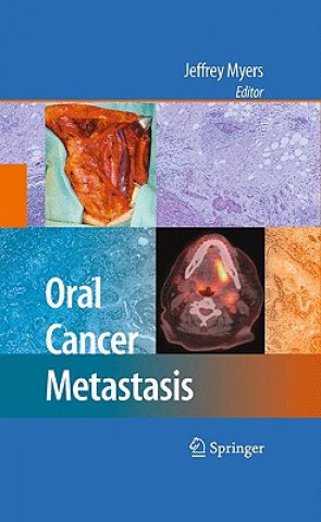 Kniha Oral Cancer Metastasis Jeffrey Myers