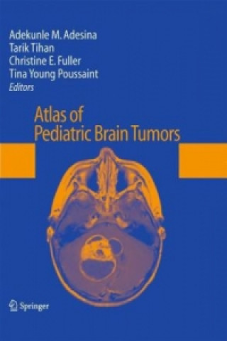 Book Atlas of Pediatric Brain Tumors Adekunle M. Adesina