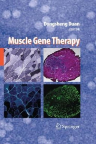 Carte Muscle Gene Therapy Dongsheng Duan