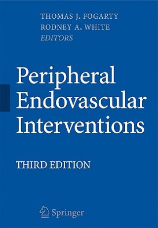 Boek Peripheral Endovascular Interventions Thomas J. Fogarty