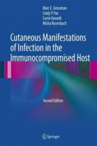 Carte Cutaneous Manifestations of Infection in the Immunocompromised Host Marc E. Grossman
