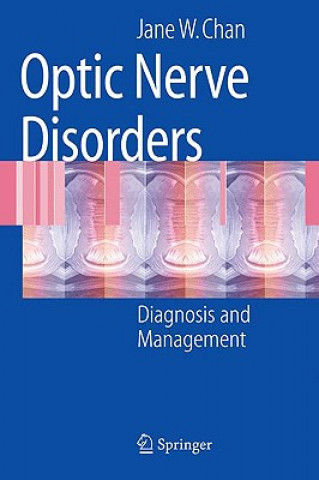 Carte Optic Nerve Disorders Jane W. Chan