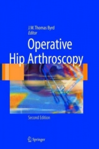 Knjiga Operative Hip Arthroscopy J.W. Thomas Byrd