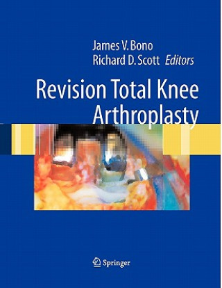 Kniha Revision Total Knee Arthroplasty James V. Bono