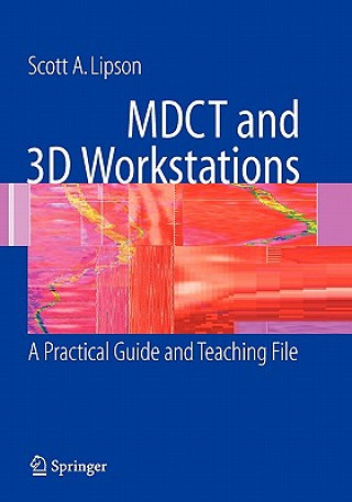 Könyv MDCT and 3D Workstations Scott A. Lipson
