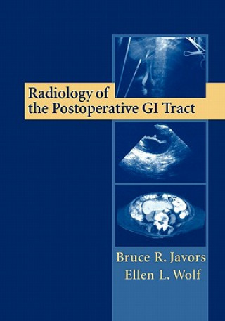 Könyv Radiology of the Postoperative GI Tract Bruce R. Javors