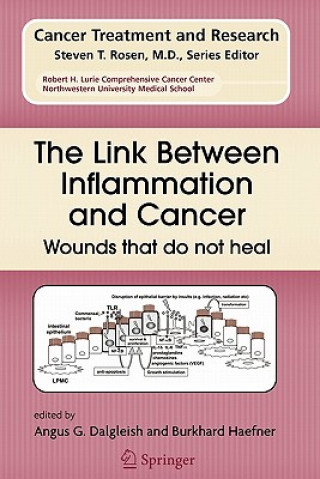 Kniha Link Between Inflammation and Cancer Angus G. Dalgleish