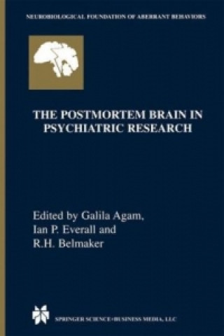 Carte Postmortem Brain in Psychiatric Research Galila Agam
