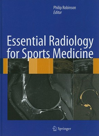 Carte Essential Radiology for Sports Medicine Philip Robinson