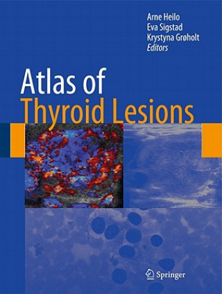 Kniha Atlas of Thyroid Lesions Arne Heilo