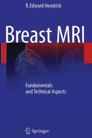 Kniha Breast MRI R. Edward Hendrick