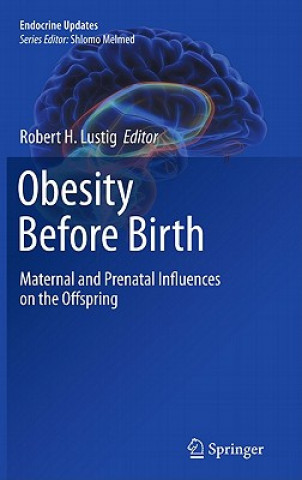 Kniha Obesity Before Birth Robert H. Lustig