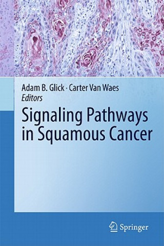 Książka Signaling Pathways in Squamous Cancer Adam B. Glick