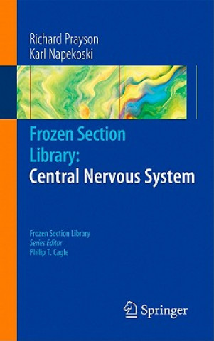 Carte Frozen Section Library: Central Nervous System Richard A. Prayson