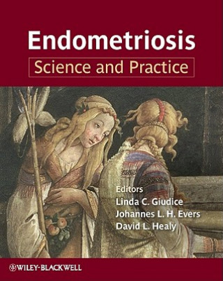 Livre Endometriosis - Science and Practice Linda C. Giudice