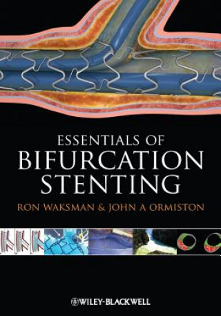 Könyv Bifurcation Stenting Ron Waksman