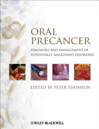 Kniha Oral Precancer Peter Thomson
