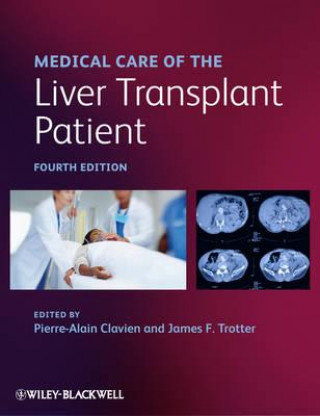 Kniha Medical Care of the Liver Transplant Patient 4e Pierre-Alain Clavien