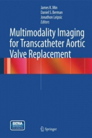 Kniha Multimodality Imaging for Transcatheter Aortic Valve Replacement James K. Min