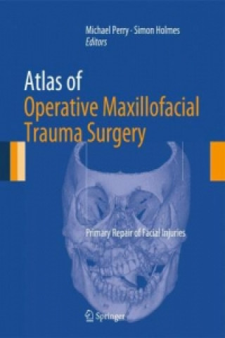 Книга Atlas of Operative Maxillofacial Trauma Surgery Michael J Perry