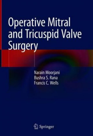 Βιβλίο Operative Mitral and Tricuspid Valve Surgery Narain Moorjani