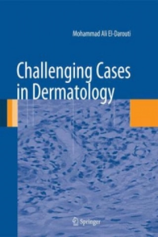 Knjiga Challenging Cases in Dermatology Mohammad A. El-Darouti