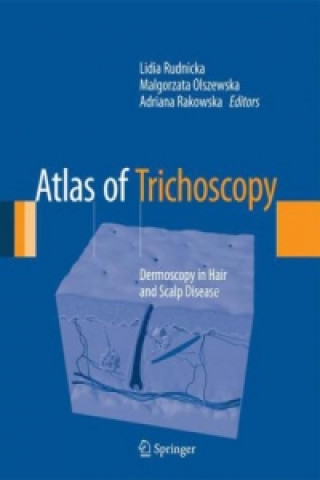 Kniha Atlas of Trichoscopy Lidia Rudnicka