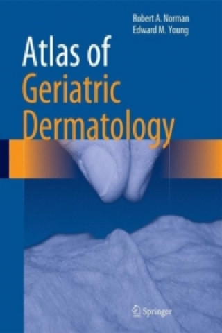 Kniha Atlas of Geriatric Dermatology Robert A. Norman