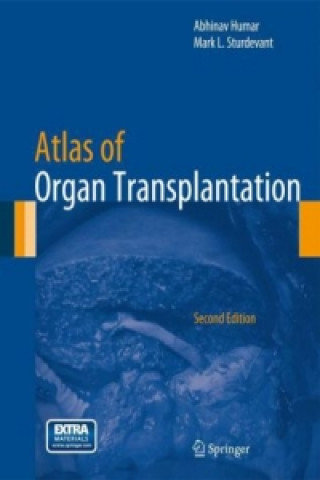 Kniha Atlas of Organ Transplantation Abhinav Humar