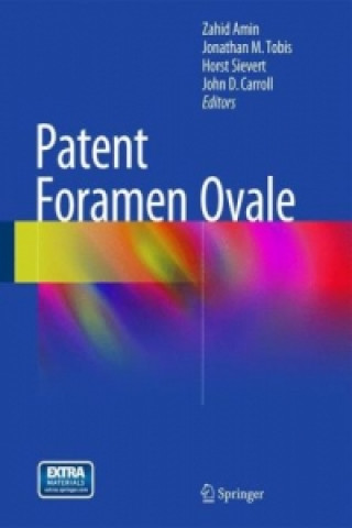 Kniha Patent Foramen Ovale Zahid Amin