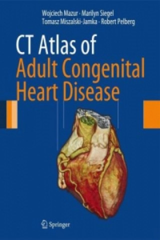 Könyv CT Atlas of Adult Congenital Heart Disease Wojciech Mazur