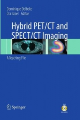 Книга Hybrid PET/CT and SPECT/CT Imaging Dominique Delbeke
