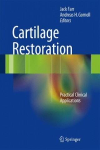 Βιβλίο Cartilage Restoration Jack Farr