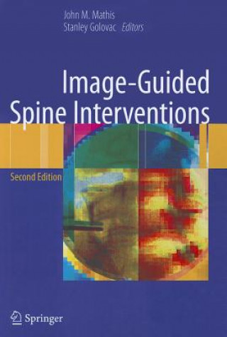 Kniha Image-Guided Spine Interventions John Mathis